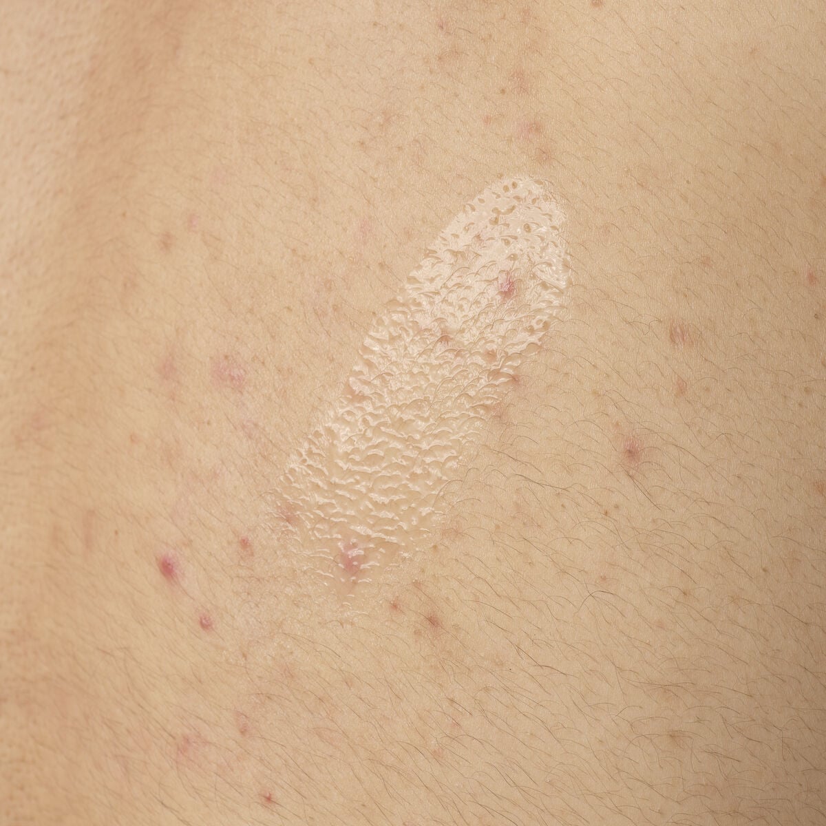 Salicylic Acid 0.5% Body Serum J1 image 8