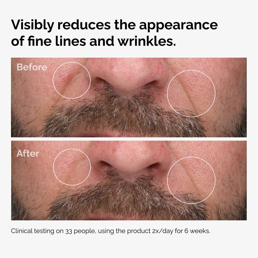 100% Fermented Rose Hip Seed Oil D9 image 6