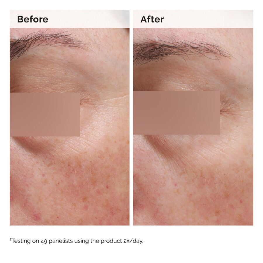 Niacinamide 5% Face and Body Emulsion H4 image 3