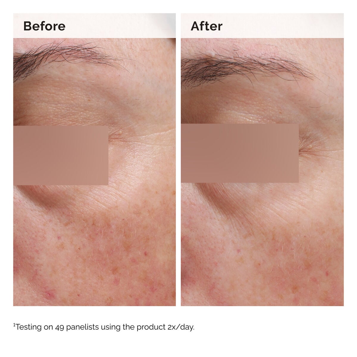 Niacinamide 5% Face and Body Emulsion H4 image 8