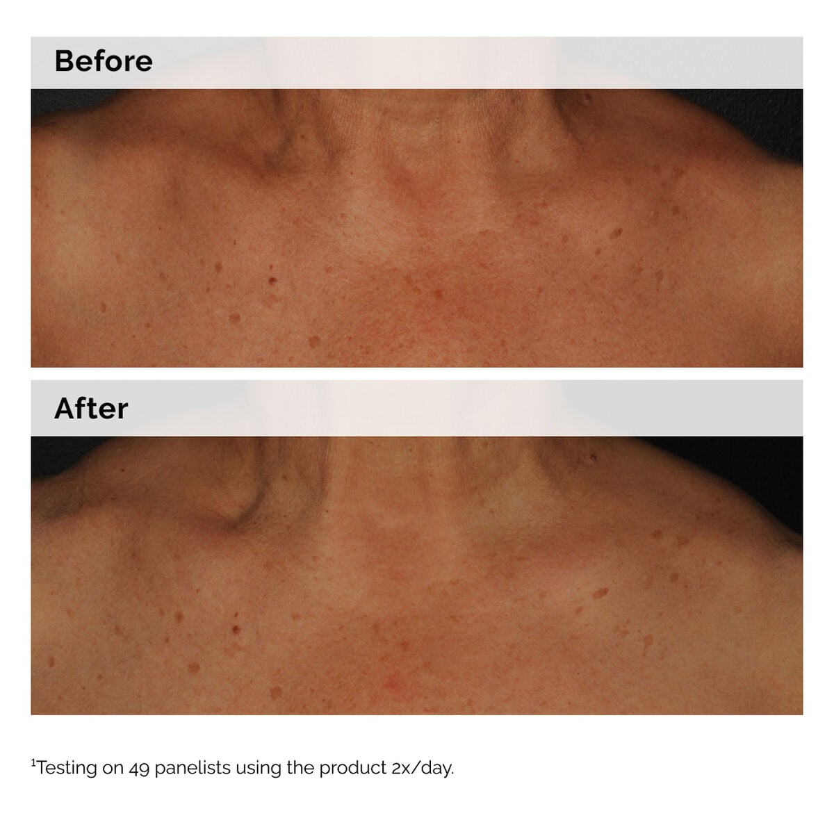 Niacinamide 5% Face and Body Emulsion H4 image 7