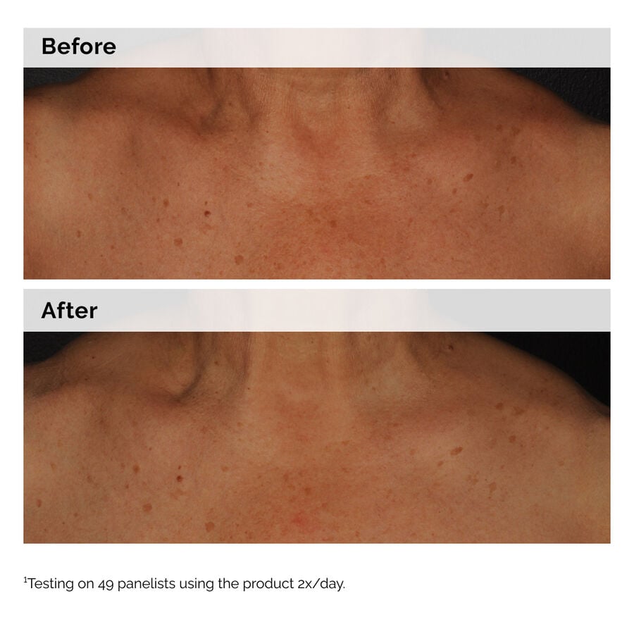 Niacinamide 5% Face and Body Emulsion H4 image 2