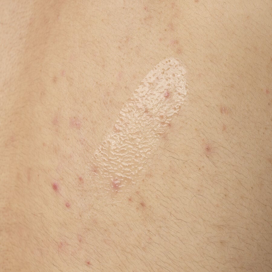 Salicylic Acid 0.5% Body Serum J1 image 4