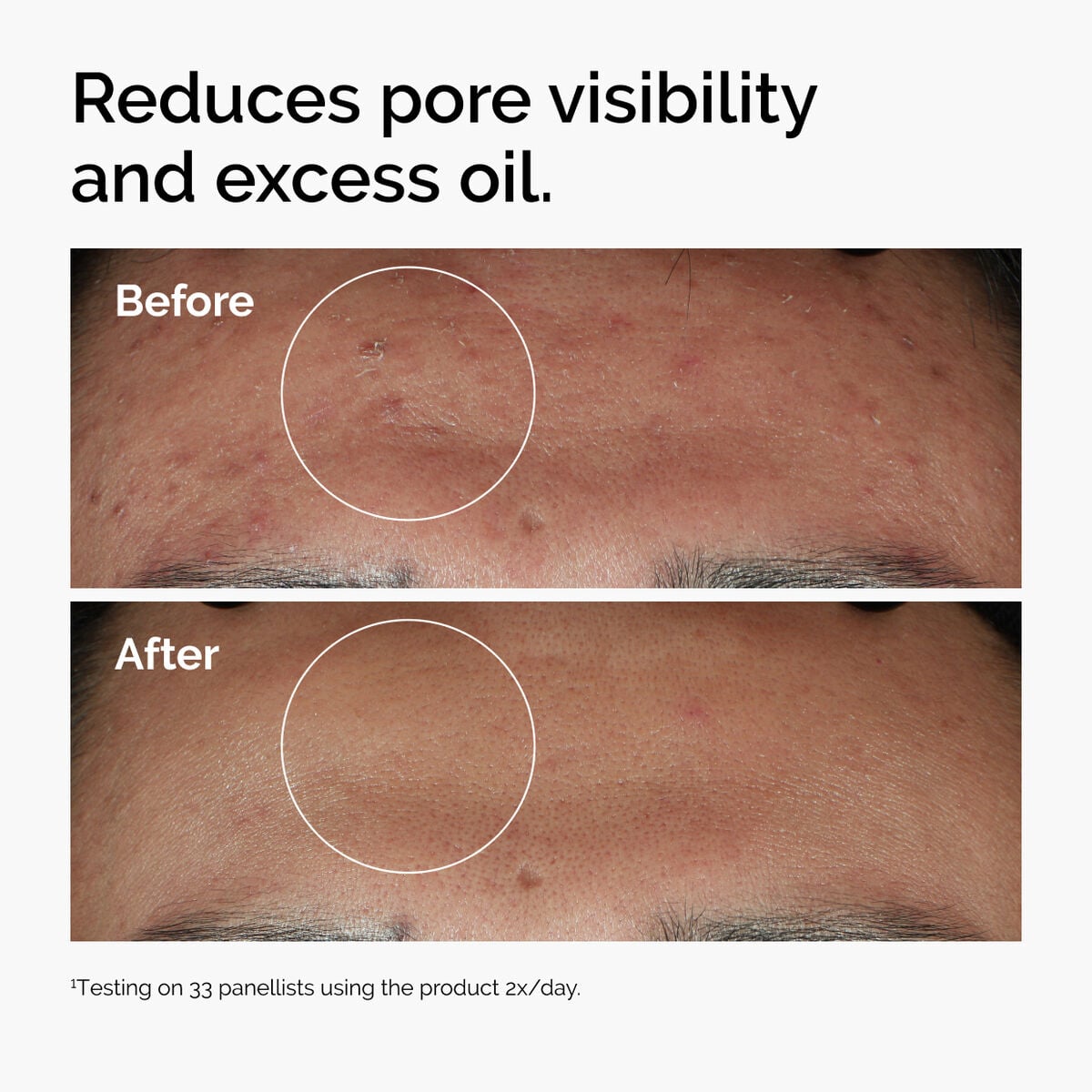 Niacinamide 10% + Zinc 1% P0 image 10