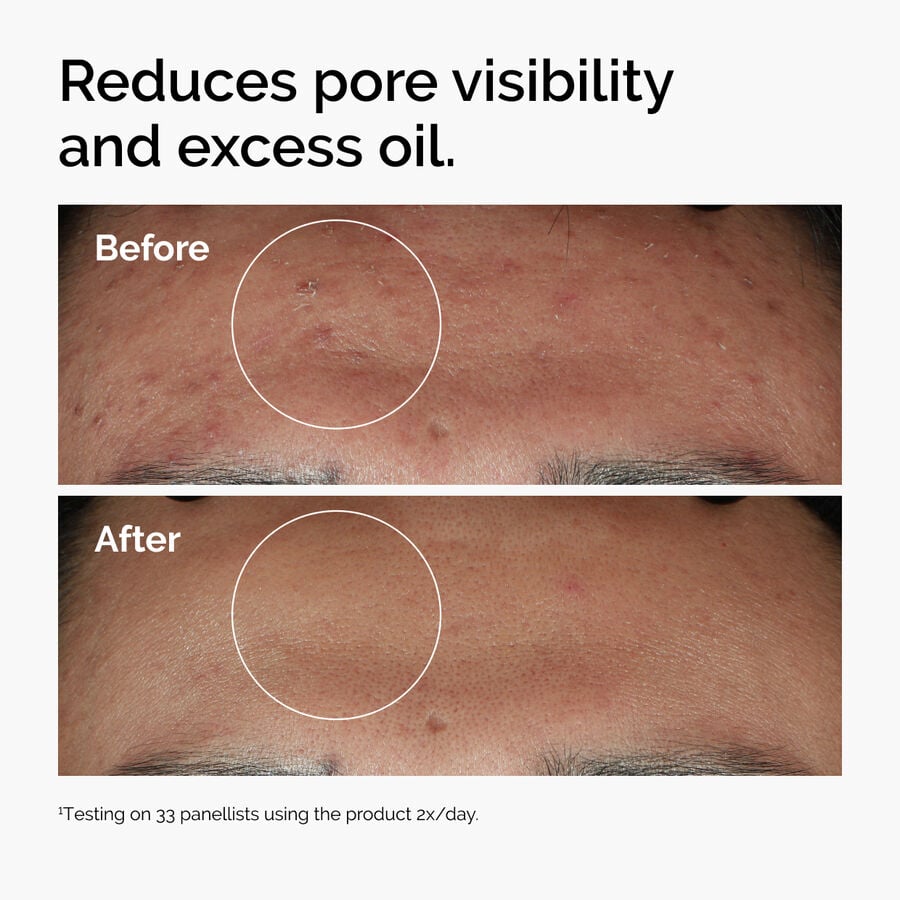 Niacinamide 10% + Zinc 1% P0 image 4