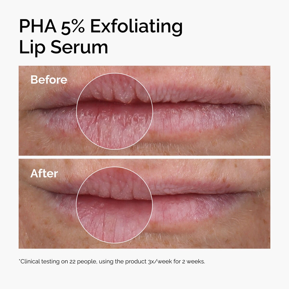 PHA 5% Exfoliating Lip Serum U3 image 9