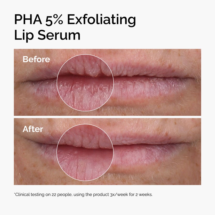 PHA 5% Exfoliating Lip Serum U3 image 3